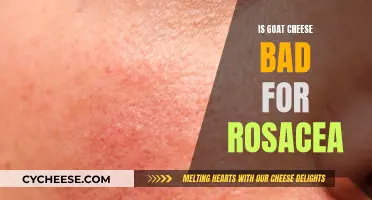 Goat Cheese and Rosacea: What's the Connection?