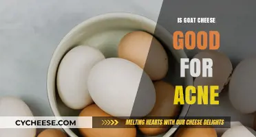 Goat Cheese and Acne: Is It Helpful or Harmful?