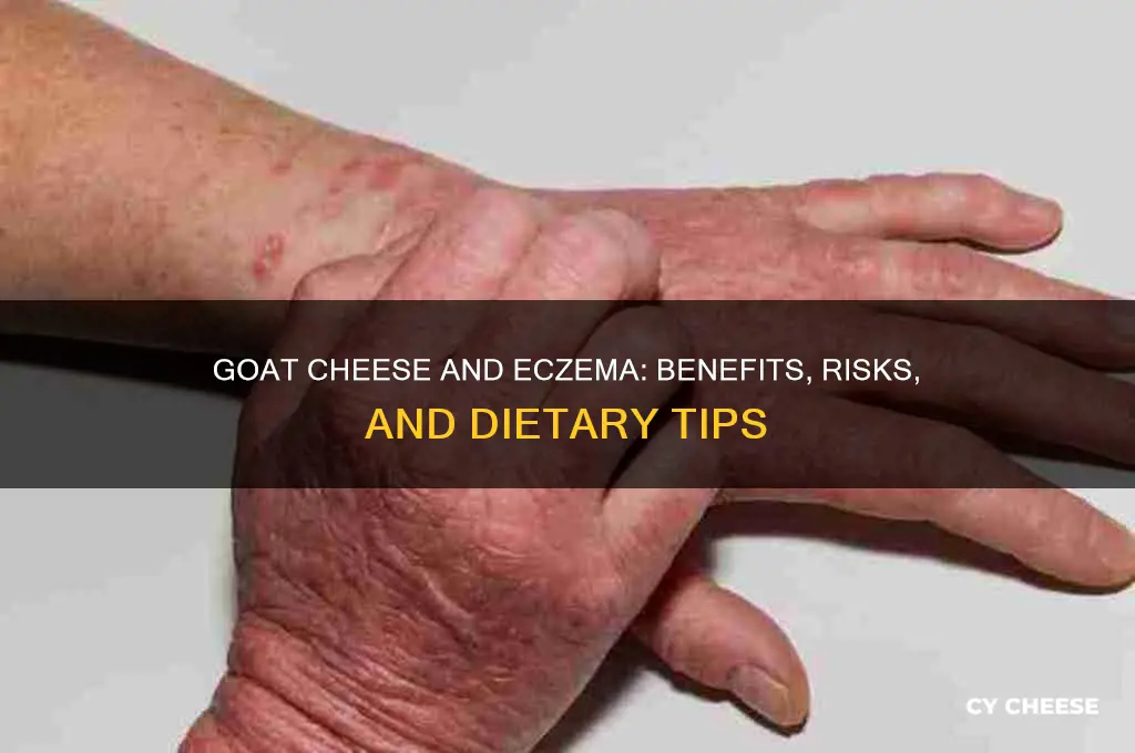 is goats cheese good for eczema