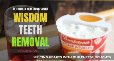 Cheese and Wisdom Teeth: What's the Deal?
