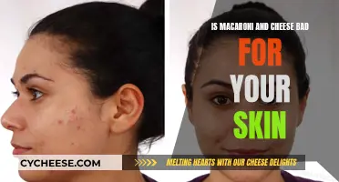 Mac and Cheese: Friend or Foe for Skin Health?