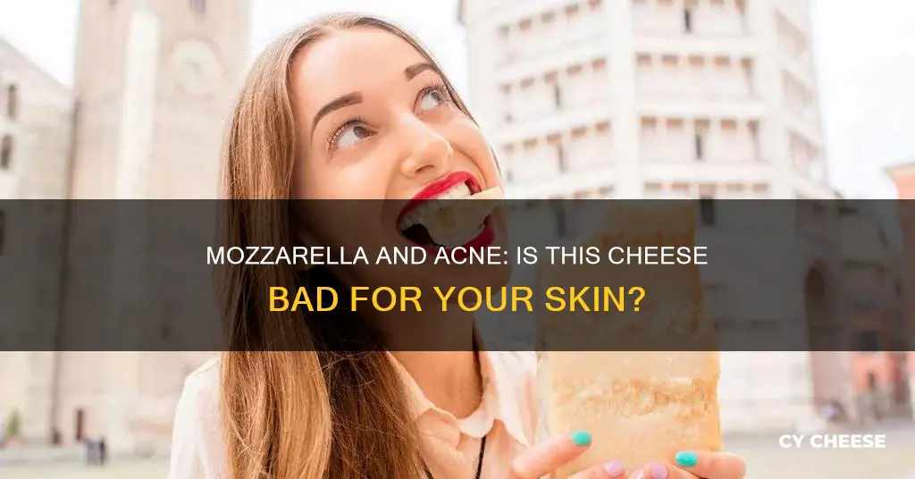 is mozzarella cheese bad for acne