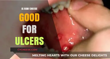 Raw Cheese and Ulcers: Benefits, Risks, and Healing Potential Explained