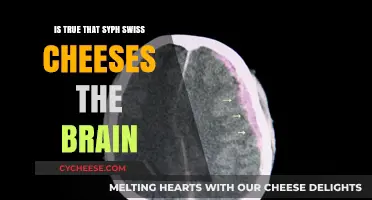 Swiss Cheeses and Brain: Separating Syphilis Fact from Fiction