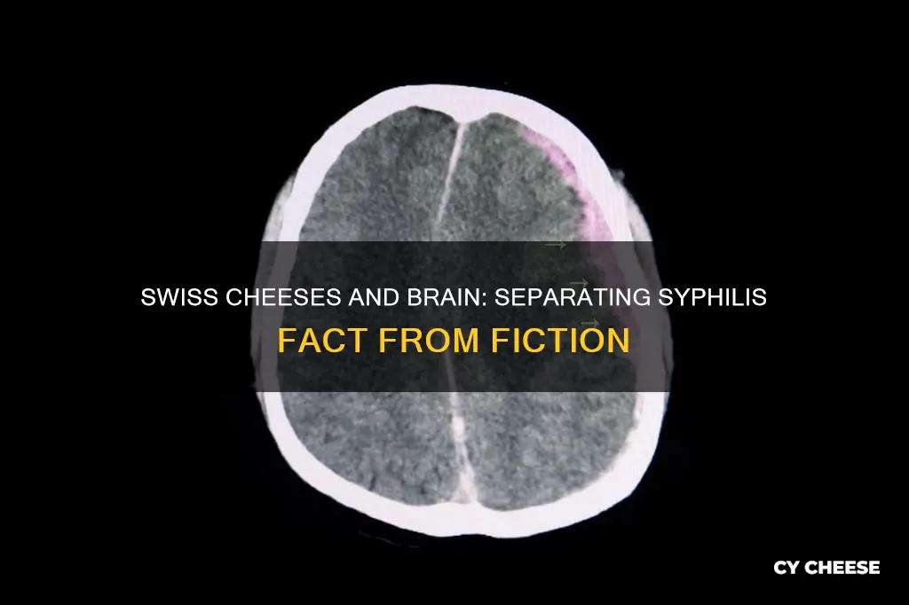 is true that syph swiss cheeses the brain