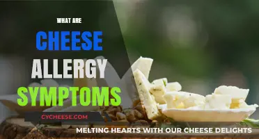 Understanding Cheese Allergy Symptoms: Signs, Causes, and Management Tips