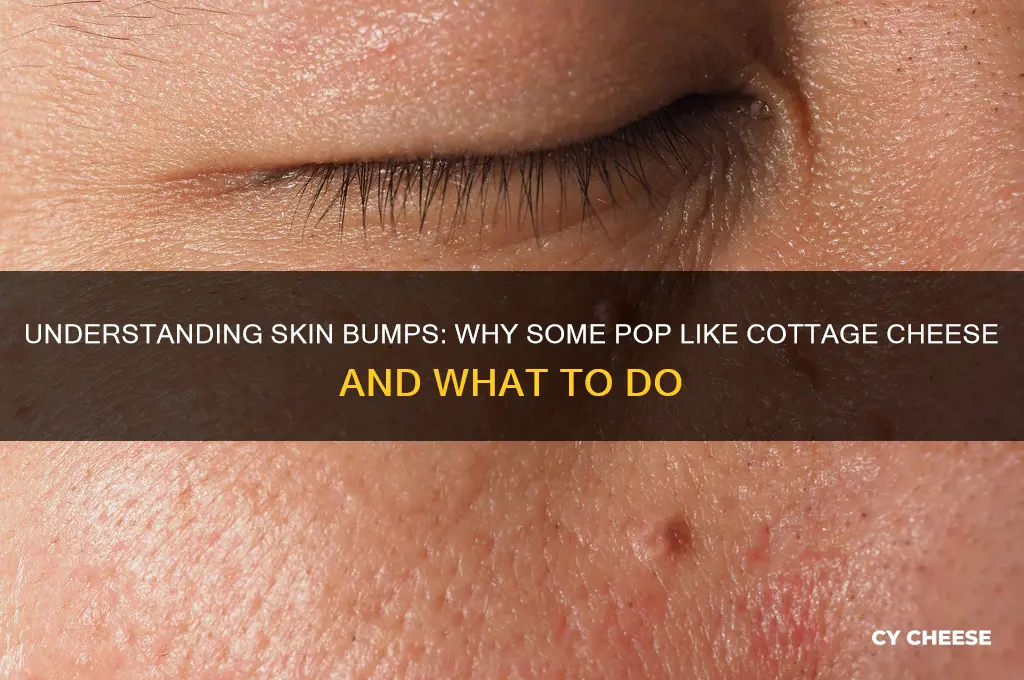 what bump pops like cottage cheese