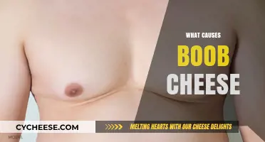 Understanding Boob Cheese: Causes, Prevention, and When to Seek Help