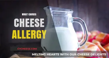 Understanding Cheese Allergy: Causes, Symptoms, and Prevention Tips