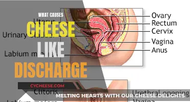 Cheese-Like Vaginal Discharge: What's the Cause?