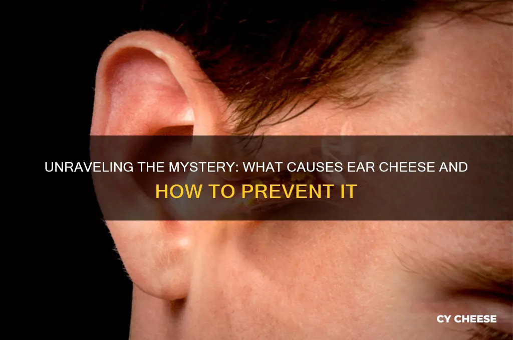 what causes ear cheese
