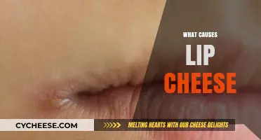 Understanding Lip Cheese: Causes, Prevention, and Effective Treatment Options