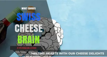 Swiss Cheese Brain: What's Causing the Forgetfulness?