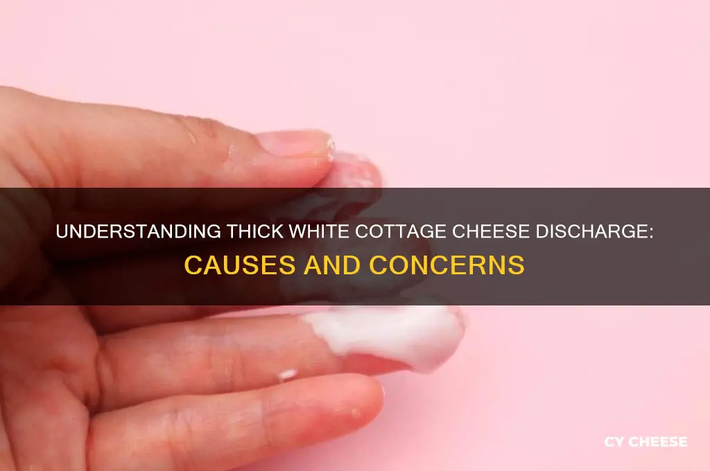 what causes thick white cottage cheese discharge