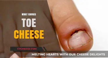 Unveiling the Smelly Truth: What Causes Toe Cheese and How to Prevent It