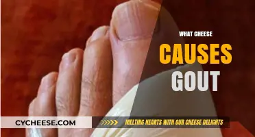 Cheese and Gout: Which Varieties Trigger Flare-Ups?