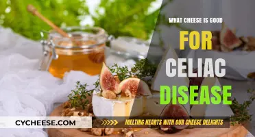Gluten-Free Cheese Guide: Safe and Delicious Options for Celiac Disease