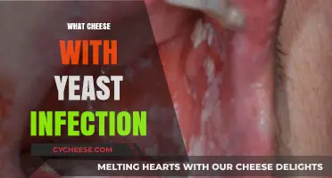 Yeast Infections and Cheese: What to Eat and Avoid for Relief