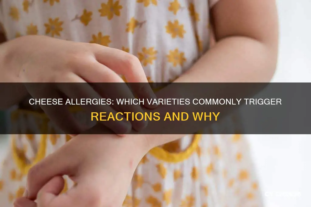 what cheeses are most likely to cause allergic reactions