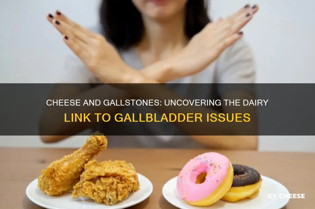what cheeses cause gall stones