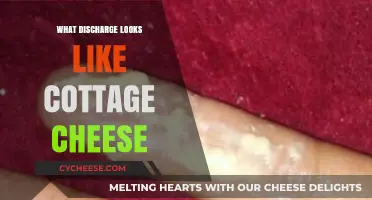 Cottage Cheese-Like Discharge: Causes, Concerns, and When to Seek Help