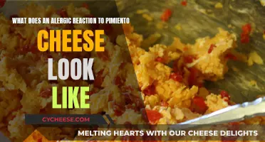 Pimiento Cheese Allergy: What Are the Symptoms?