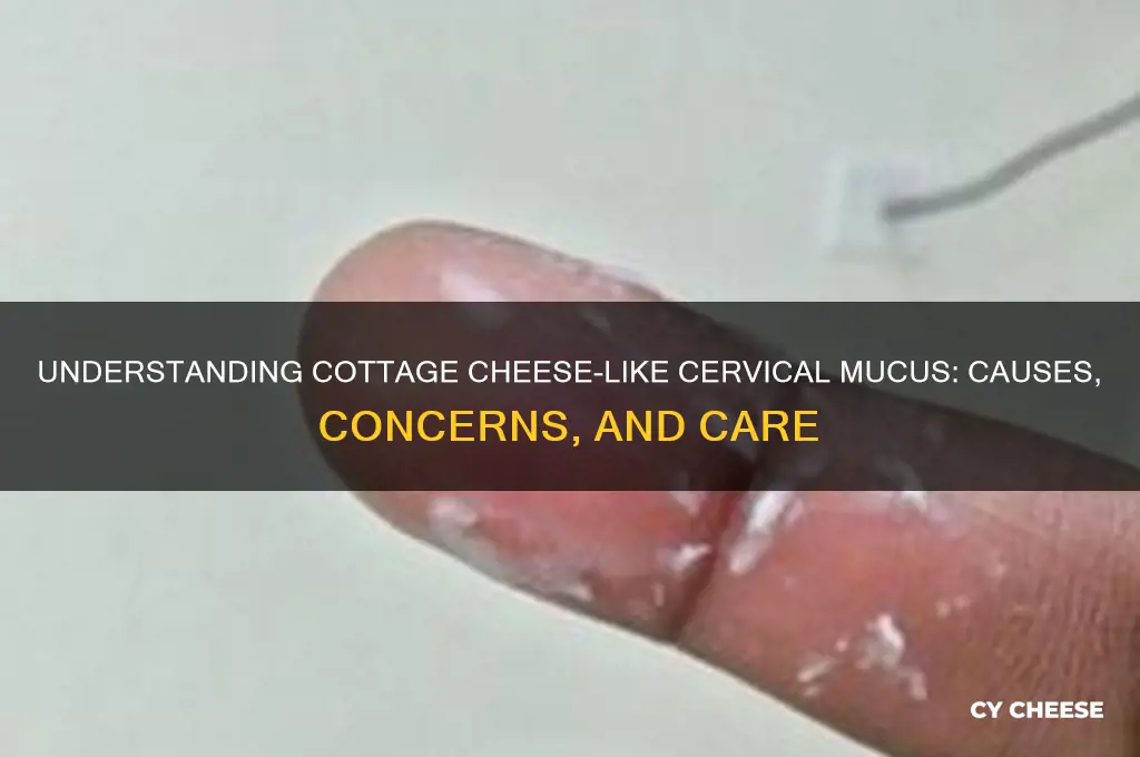 what does cottage cheese cervical mucus mean