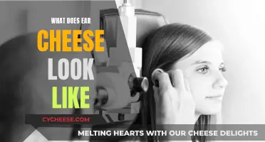 Ear Cheese: What It Looks Like and Why