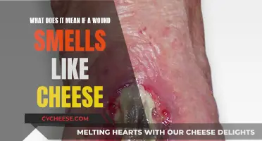 Unusual Smell from a Wound: Could It Be Cheese?