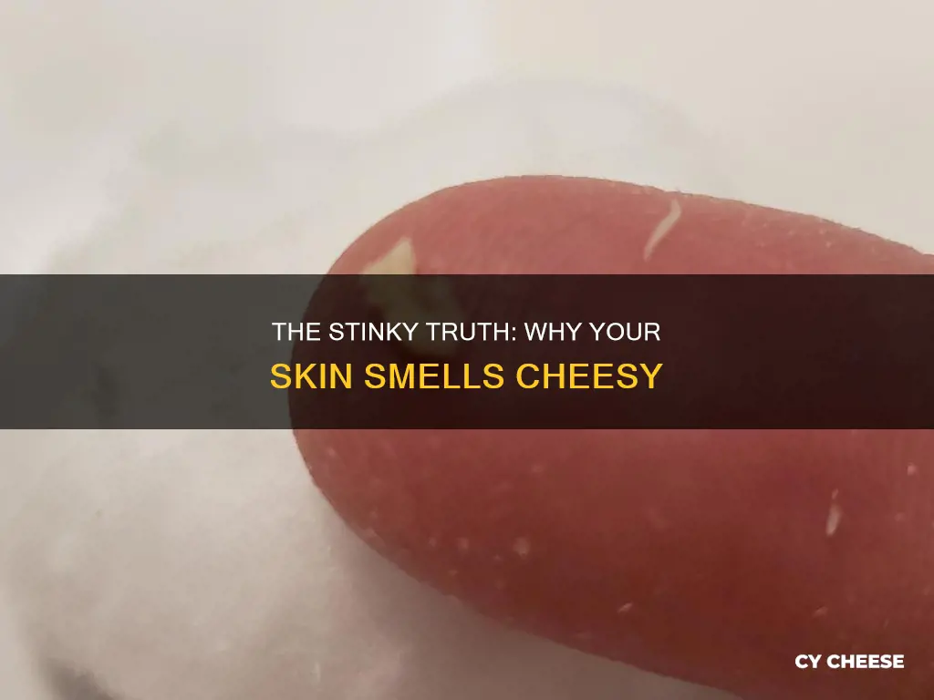 what does it mean when your skin smells like cheese