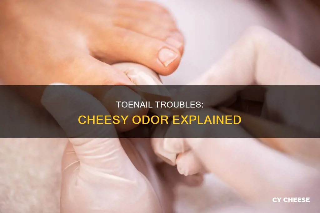 what does it mean when your toenails smell like cheese