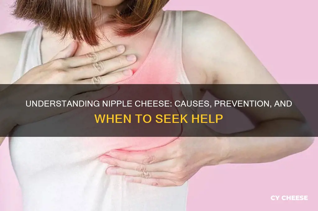 what does nipple cheese mean