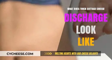 Understanding Thick Cottage Cheese-Like Discharge: Causes, Symptoms, and Treatment