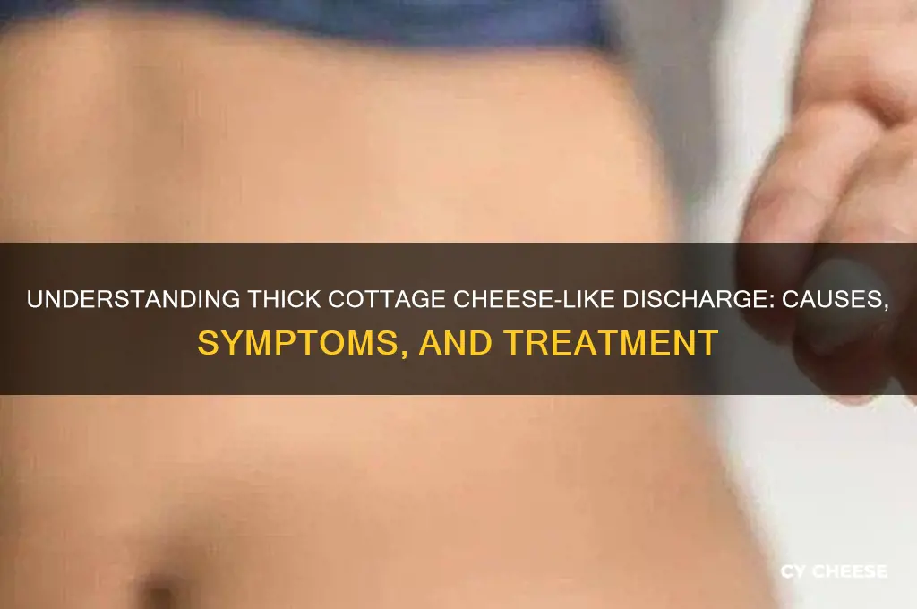 what does thick cottage cheese discharge look like