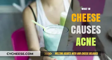 Cheese and Acne: Uncovering the Dairy-Skin Connection
