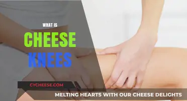 Understanding Cheese Knees: Causes, Symptoms, and Effective Treatment Options