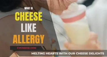 Unraveling the Mystery: Understanding Cheese Allergies and Their Impact