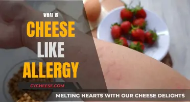 Cheese Intolerance: Understanding Allergic Reactions to Dairy