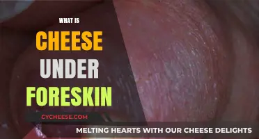 Understanding Smegma: What's That Cheese-Like Substance Under Foreskin?
