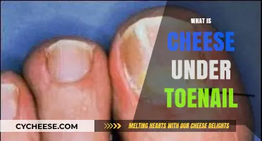 Unraveling the Mystery: Cheese Under Toenail Explained and Remedies