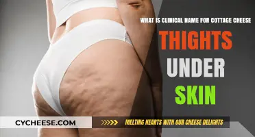 Understanding Cellulite: The Clinical Term for Cottage Cheese Thighs Explained