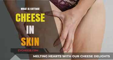 Cottage Cheese Skin: Causes, Treatments, and Prevention Tips