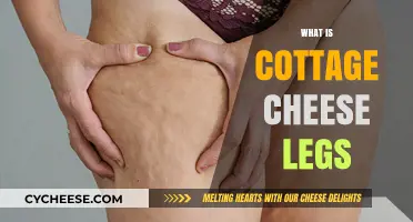 Understanding Cottage Cheese Legs: Causes, Symptoms, and Treatment Options