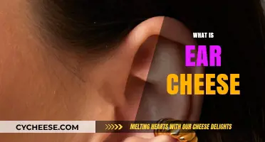 What is Ear Cheese? Uncovering the Surprising Truth Behind This Oddity