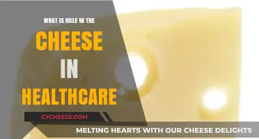 Uncovering the Gaps: Understanding the 'Hole in the Cheese' in Healthcare