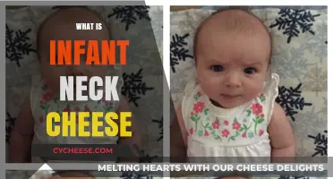 Understanding Infant Neck Cheese: Causes, Prevention, and Gentle Care Tips
