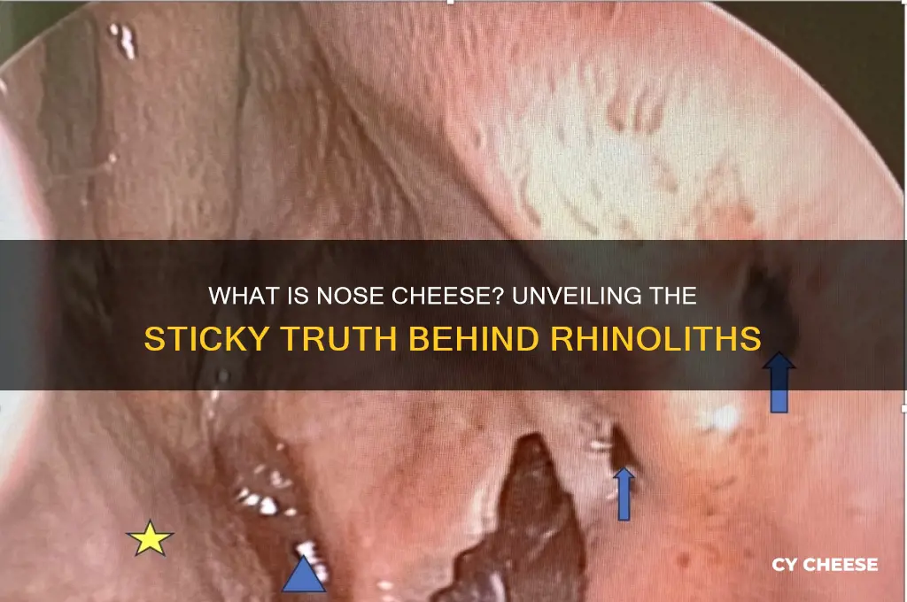 what is nose cheese