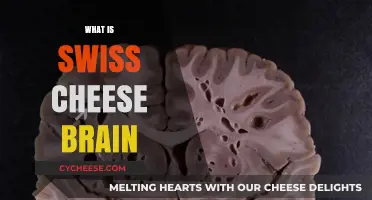Swiss Cheese Brain: Understanding Memory Loss