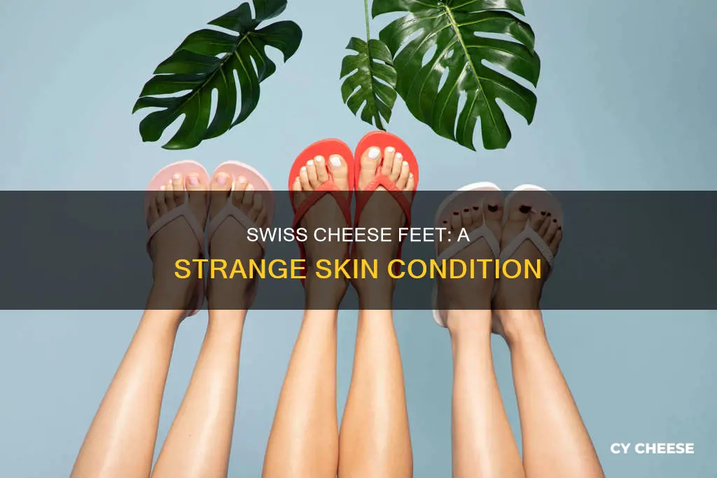 what is swiss cheese feet