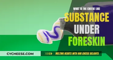 Cheese-Like Substance Under Foreskin: What's the Deal?